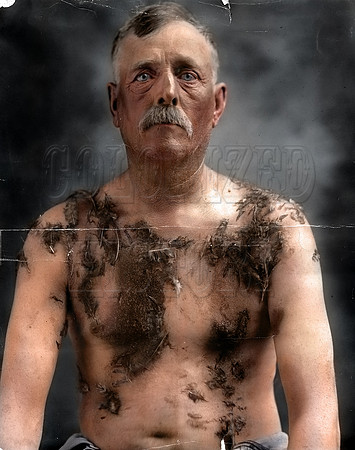 John Meints, after being tarred & feathered