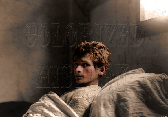 Guiseppe Uggesi, an Italian soldier in 223rd Infantry, who was in an Austrian Prison Camp at Milowitz, confined to bed with tuberculosis in January of 1919